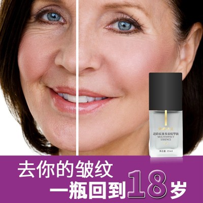 面部抗皱精华液玻尿酸修复紧致补水抗老青春定格液玻尿酸去皱原液图4