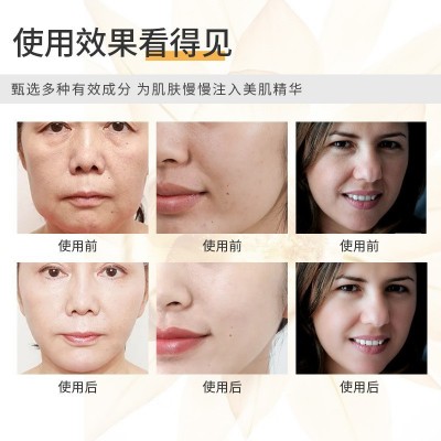 微晶法令纹贴提拉抗皱紧致保湿淡化细纹水凝胶面膜贴法令纹贴批发图2