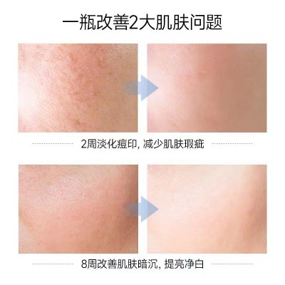美容院美白霜正品烟酰胺水乳淡斑去斑高保湿面霜护肤品批发代加工图3