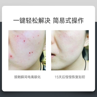 去斑扫斑德国小白点痣笔激光取祛斑专用美容仪器神点痔去痣点斑笔图4