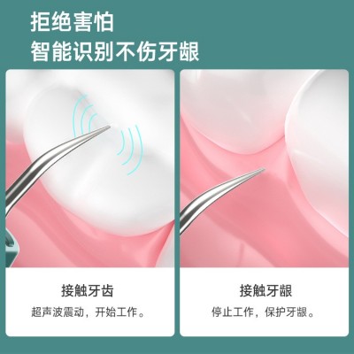 新款高清可视洁牙仪去牙垢牙结石牙齿美白神器洗牙器超声波美牙仪图4