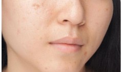 轻松淡化色斑，从这些日常护肤开始吧