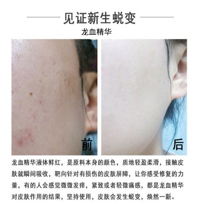 龙血焕颜精华液逆龄提亮肤色淡化皱纹提拉修护红血丝青春定格原液图5