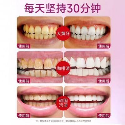 5D炫白牙贴牙齿美牙贴炫白牙齿批发现货酵素凝胶3D 9D美白牙贴图2
