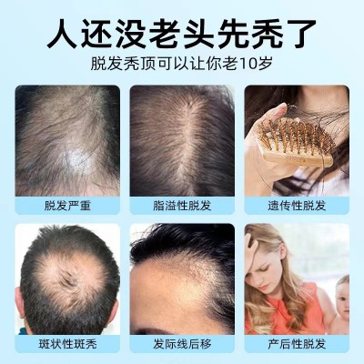 2023头皮生发导入仪家用MTS中胚层无针免麻冻干粉浅导微晶美容仪2个图3