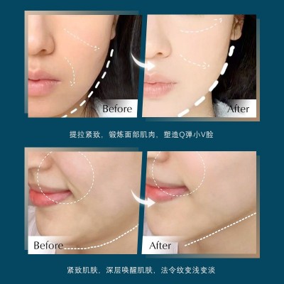 【厂家直销】ADAD电动导入高频按摩美容仪提拉紧致脸部院线专供图5