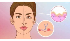 NEJM：晒太阳加速皮肤衰老——不可逆？这项医美别错过