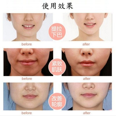 双V脸面膜 提拉紧致面膜白色双V水凝胶原绷带面膜亚马逊跨境出口图2