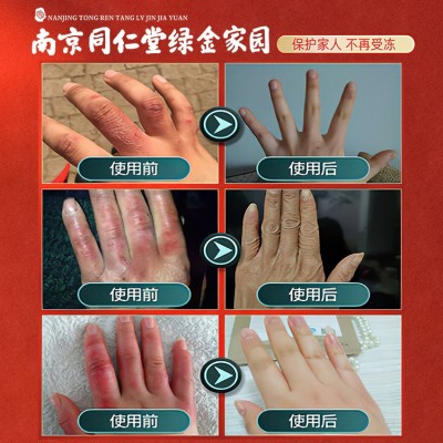 红花蛇油防冻膏滋润防手裂脚裂干裂止痒马油膏冻疮膏修护止痒皲裂图3