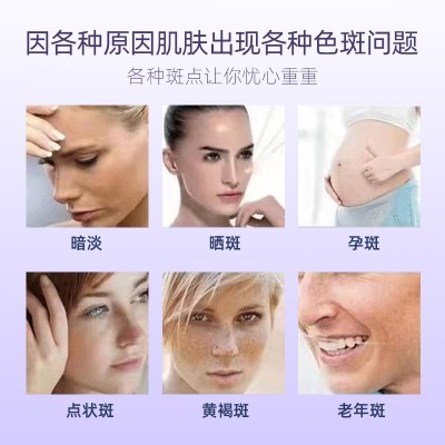 一秒擦斑液提取液雀斑老年斑祛斑金水零结痂美白无创祛斑液化妆品图3