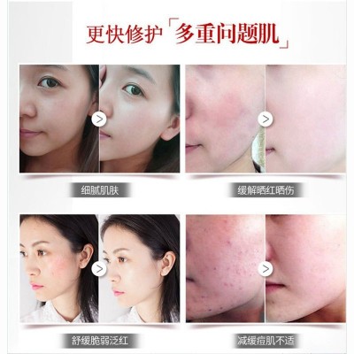 美容院修复因子 点斑点痣取术后烫烧伤破皮修护角质层术后修护肽图3