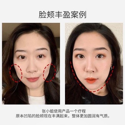新款脸部丰盈液丰太阳穴精液去凹陷泪沟法令纹抬头纹脸部填充原液图4