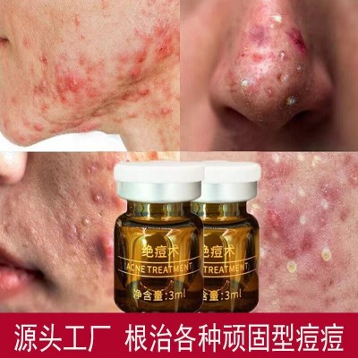 草本绝痘术微晶去痘印粉刺青春痘修护祛痘水美容院祛痘精华液批发图2