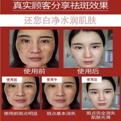 熊果苷原液vc美白精华液淡化祛斑黄褐斑雀斑祛斑液溶斑液排色液图4