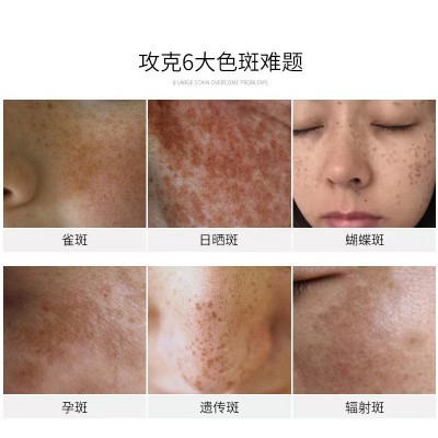 熊果苷原液vc美白精华液淡化祛斑黄褐斑雀斑祛斑液溶斑液排色液图3