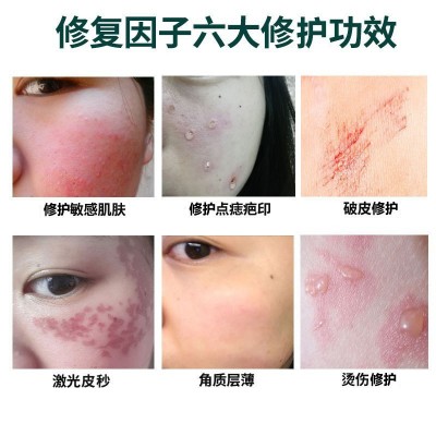 美容院修护因子凝胶点斑点痣后冰晶秋季面部退红重组修护乳霜批发图4