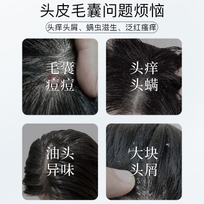 乐家老铺毛炎氨基酸宁洗发水露厂家批发修复毛囊植物除螨洗头膏图3