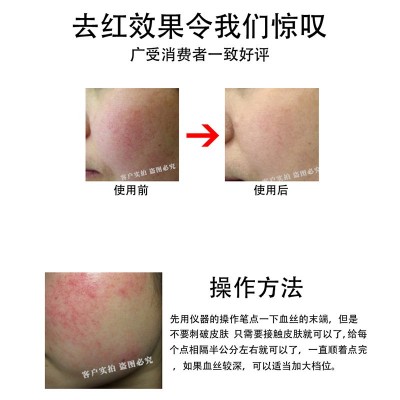 出口版祛红血丝仪器美容院980高频净丝仪去红血丝阻断仪去除外贸图3