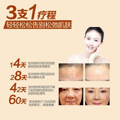 PRP面部护肤瞬间去皱霜去皱去眼纹眼袋提拉紧至眼霜化妆品oem贴牌图4