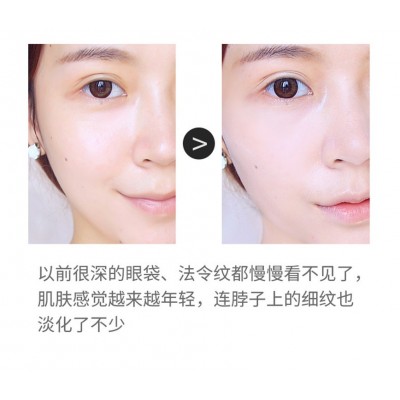 珂浦生物玻色因精华抗初老玻尿酸补水淡化细纹淡皱面部原液图5