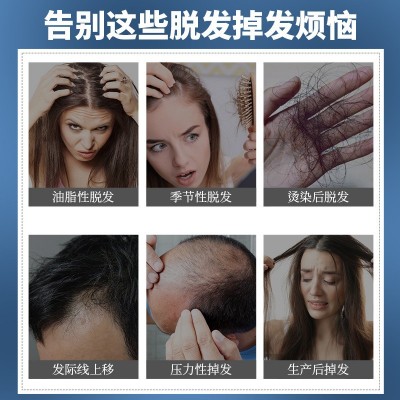 聚荣防脱育发洗发水头皮去油生发生姜洗发露植物提取配方洗发膏现图2