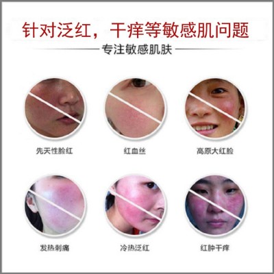 多肽修复面膜 去瘙痒退红术后舒缓 修护敏感肌角质层激素脸修护霜图3