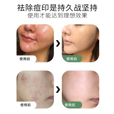海南小白盒面霜 祛痘嫩肤亮肤修护乳霜 收细毛孔月光小白盒霜批发图4