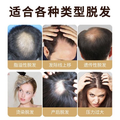 草本防脱生发液增发剂增发密发生长头发修复毛囊增长发际线育发液图2