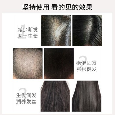 草本防脱生发液增发剂增发密发生长头发修复毛囊增长发际线育发液图4