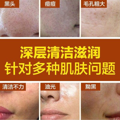 美容院专供净颜皮膜美白祛斑去黑头粉刺黑色素五天吸斑膜撕拉面膜图3