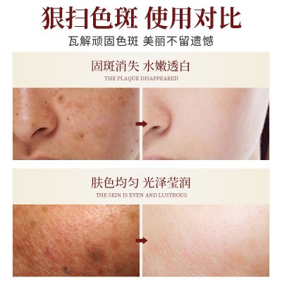 美容院专供净颜皮膜美白祛斑去黑头粉刺黑色素五天吸斑膜撕拉面膜图2