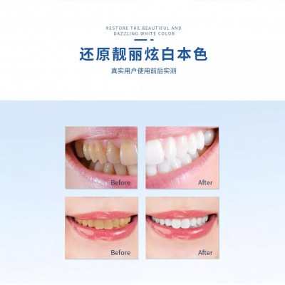 艺术咖槟榔亮白盒装牙膏去牙渍口气牙膏按压瓶装口腔护理牙膏批发图4
