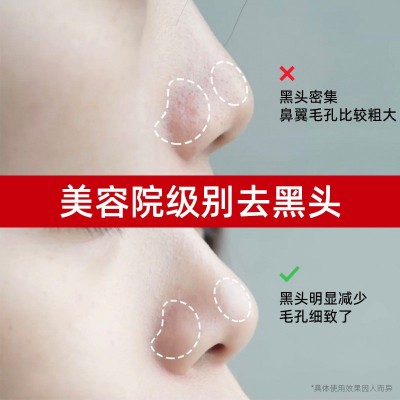 小气泡黑头导出液 去黑头白头粉刺美容院T区护理套装黑头导出液图3