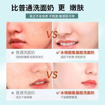 水杨酸氨基酸洁面乳温和控油洗面祛痘深层清洁毛孔除螨去黑头图4