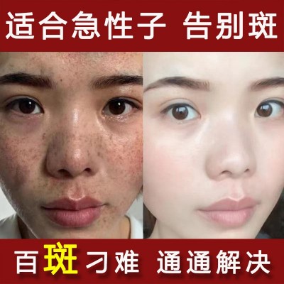 特证377祛斑霜美白去黑色素面霜雀斑黄褐斑老年斑美容院控色霜图2