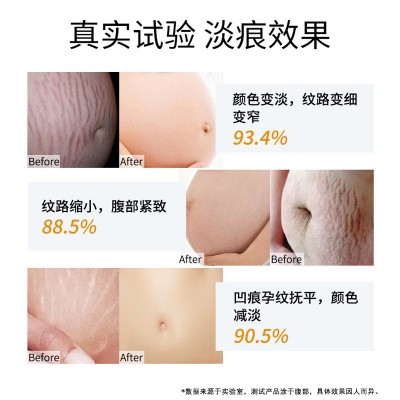 妊娠纹修复霜产后去孕纹淡化肥胖纹润肤预防生长纹祛妊娠纹疤痕膏图3