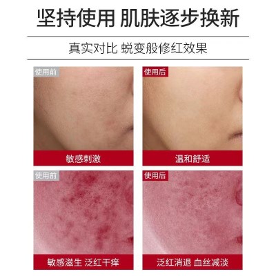 神经酰胺原液舒缓退红去红血丝修护角质层敏感肌激素脸修复精华液图3