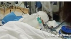 两起隆鼻死亡事故，医美机构到底多乱？