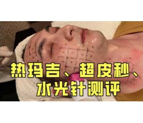 热玛吉、超皮秒、水光针价格、疼痛度、效果对比，医美项目攻略