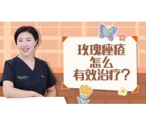 玫瑰痤疮怎么有效治疗？