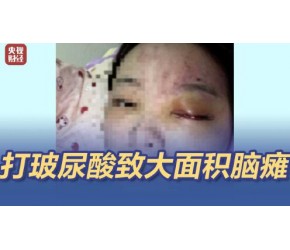 315曝光医美速成班 女孩打玻尿酸致大面积脑梗