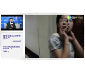 痉挛状态肉毒毒素治疗——李铁山