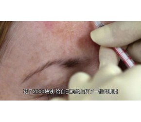 世界上最致命的毒素，肉毒杆菌真的安全吗？