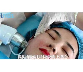 INUS官方操作视频